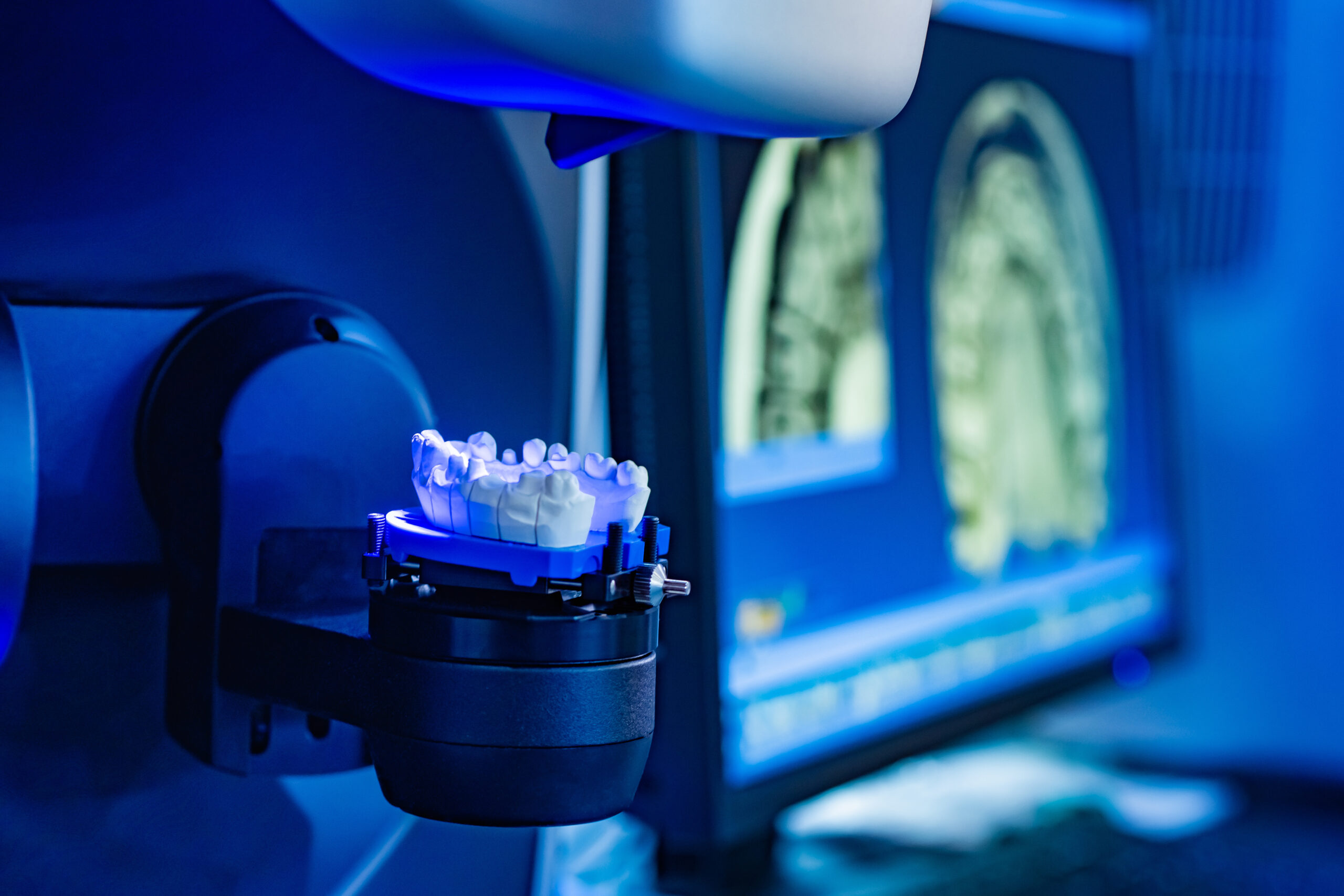 Cerec crown machine with molding attached