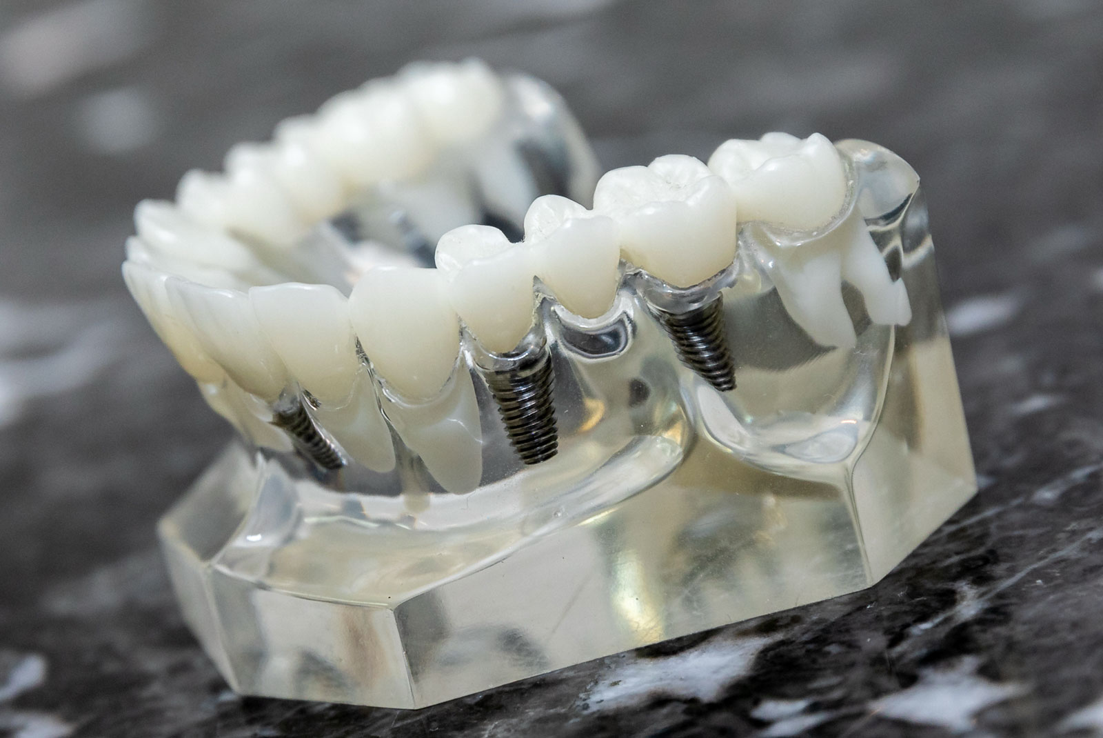 dental bridge real 5050