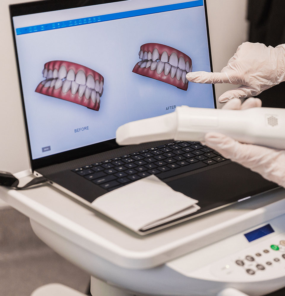 smile design preview 5050