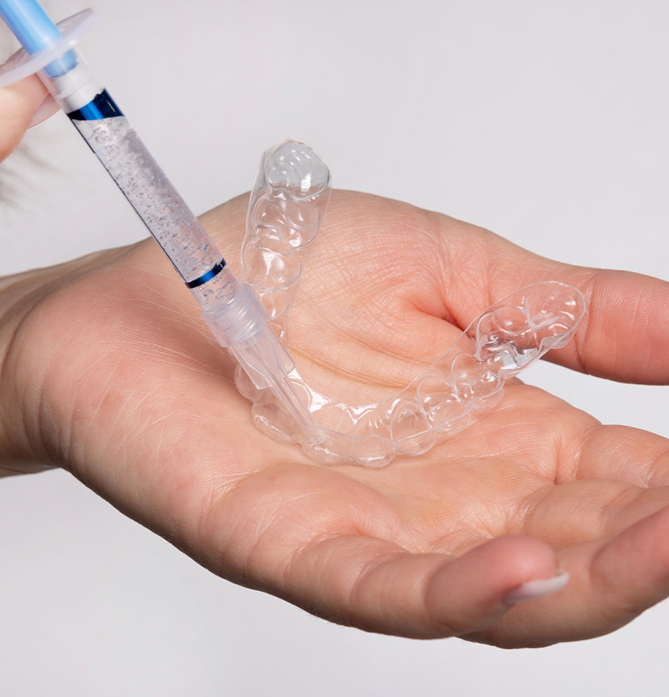 showing at home teeth whitening kit