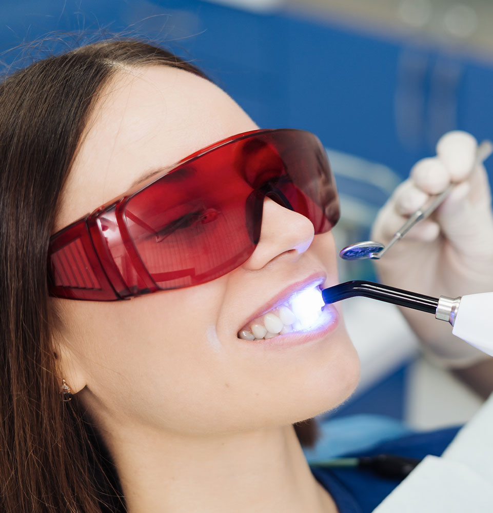 teeth whitening patient 5050