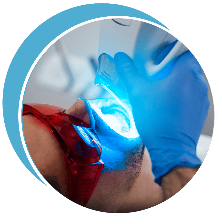 teeth whitening procedure